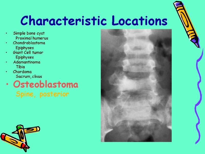 Simple bone cyst Proximal humerus Chondroblastoma Epiphyses Giant Cell tumor Epiphyses Adamantinoma Tibia Chordoma